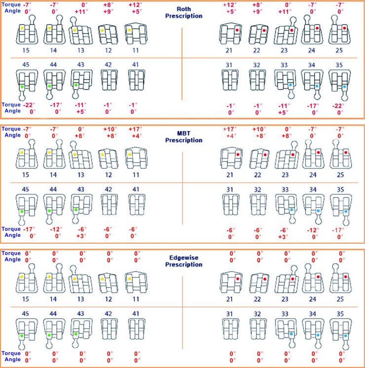 Пропись брекетов Roth и MBT