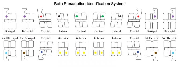 Позиционирование брекетов по высоте