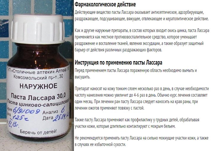 Цинковая паста Лассара