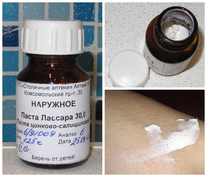 Салицилово-цинковая мазь Лассара